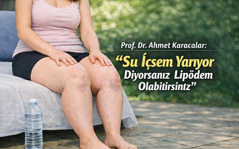 Prof. Dr. Ahmet Karacalar: “Su İçsem Yarıyor Diyorsanız Lipödem Olabilirsiniz”
